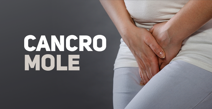Imagem com a frase 'CANCRO MOLE' em destaque à esquerda, sobre um fundo cinza escuro. À direita, aparece a parte inferior do tronco e das pernas de uma pessoa vestindo roupas claras, com as duas mãos sobre a região da virilha, sugerindo desconforto ou dor na área genital. A imagem é ilustrativa e representa a condição conhecida como cancro mole.